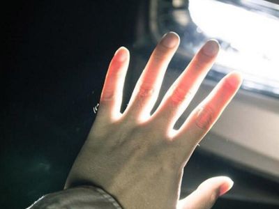Azərbaycanda avtomobil ana və 3 uşağını vuraraq ağır xəsarət yetirib Azərbaycanda avtomobil ana və 3 uşağını vuraraq ağır xəsarət yetirib