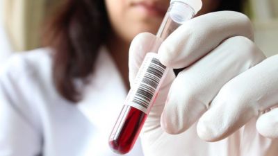 Azərbacanda bu xəstələr üçün dövlət verdiyi pulları artırdı Azərbacanda bu xəstələr üçün dövlət verdiyi pulları artırdı