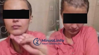 Saçı qırxılan qadına verilən işgəncə izlərinin şok görüntüləri yayıldı Saçı qırxılan qadına verilən işgəncə izlərinin şok görüntüləri yayıldı