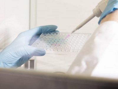 Ebolaya bənzər naməlum Menqla virusu aşkarlanıb Ebolaya bənzər naməlum Menqla virusu aşkarlanıb