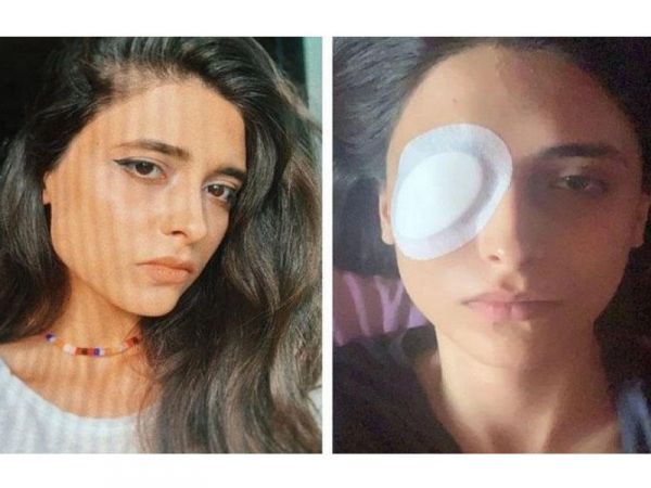 Bakıda lazer epilyasiyasında qızın gözünü zədələdilər - Kor olacaqdı Bakıda lazer epilyasiyasında qızın gözünü zədələdilər - Kor olacaqdı