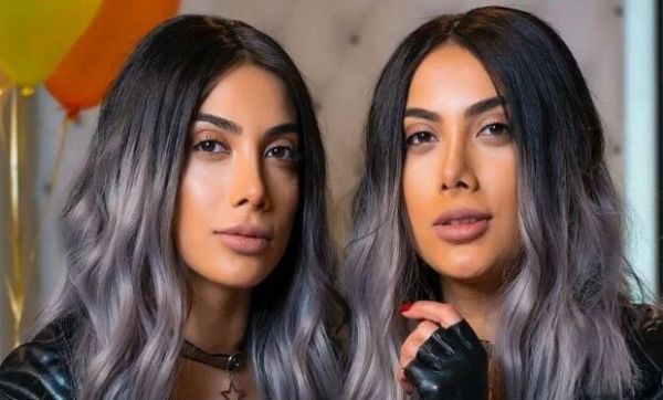 Əkizlərinelə görüntüsü yayıldı ki... - FOTO Əkizlərinelə görüntüsü yayıldı ki... - FOTO