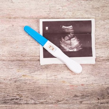 Kişilərdə də hamiləlik testi "pozitiv" çıxa bilər - Xanımlar, bu nüansa DİQQƏT - VİDEO