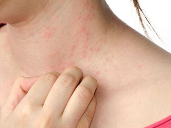 Göbələk xəstəlikləri nə zaman təhlükəlidir? Göbələk xəstəlikləri nə zaman təhlükəlidir?