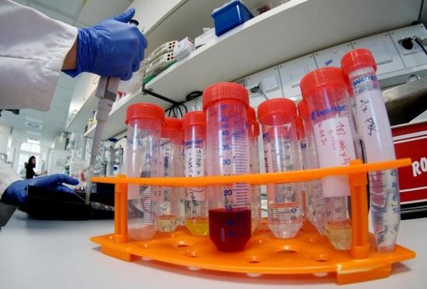 В Азербайджане провели более 25 тыс. тестов на коронавирус