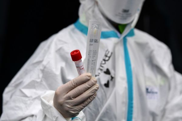 Daha 63 nəfərdə koronavirus aşkarlandı - Azərbaycanda