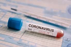 Azərbaycanda koronavirusa yoluxanların sayı 600-ü ötdü