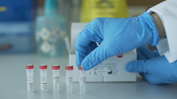 Azərbaycanda koronavirusa daha 588 yoluxma qeydə alınıb, 7 nəfər vəfat edib