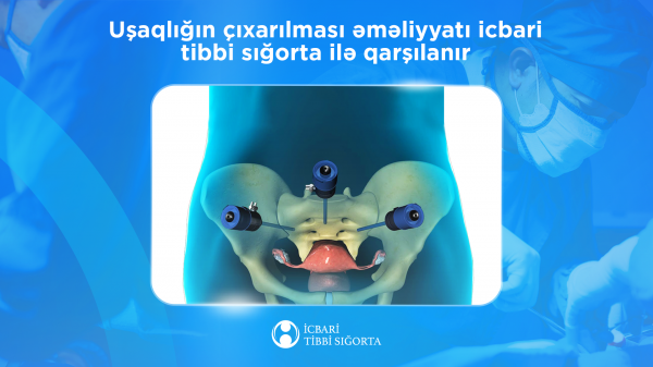İcbari tibbi sığorta uşaqlığın çıxarılması əməliyyatını qarşılayır İcbari tibbi sığorta uşaqlığın çıxarılması əməliyyatını qarşılayır