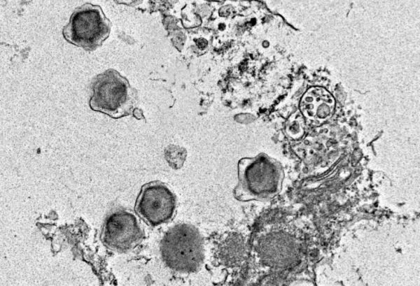 Okeanda tapılan 230 yeni nəhəng virus insan sağlamlığına təsir edə bilər - TƏDQİQAT