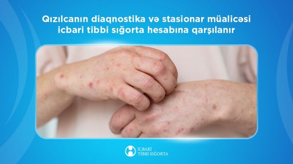 Qızılcanın diaqnostika və stasionar müalicəsi icbari tibbi sığorta hesabına qarşılanır