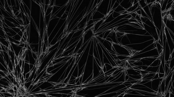 “Dark pattern”lə saytlar istifadəçiləri necə aldadır?