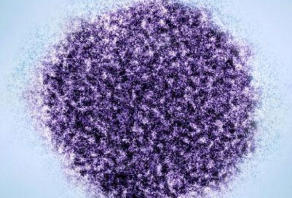 Hepatit C virusunun psixiatrik pozğunluqlarla əlaqəsi aşkarlanıb - TƏDQİQAT