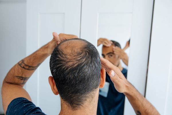 Saç tökülməsini yavaşladan məhsul - dermatoloq açıqladı