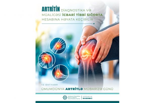 Artritin diaqnostikası və müalicəsi icbari tibbi sığorta hesabına həyata keçirilir